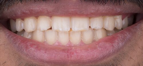 Case 36 - Before