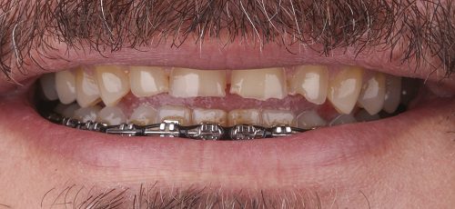 Case 2 - Before