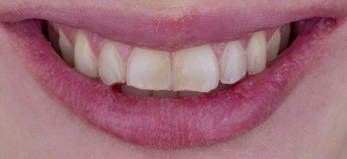 Case 3 - Before