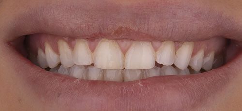 Case 29 - Before