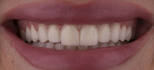 Case 29 - After