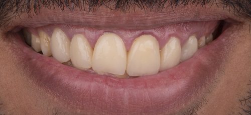 Case 5 - Before