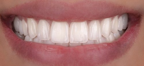 Case 6 - Before