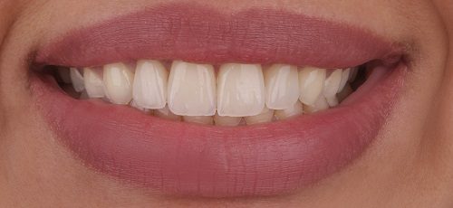 Case 8 - Before