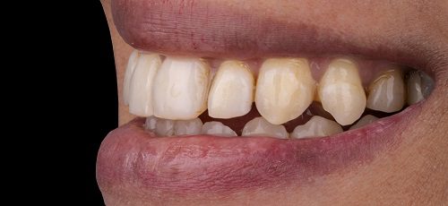 Case 14 - After