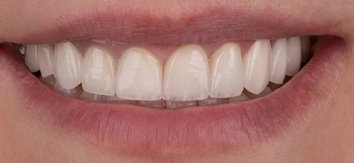 Case 9 - Before