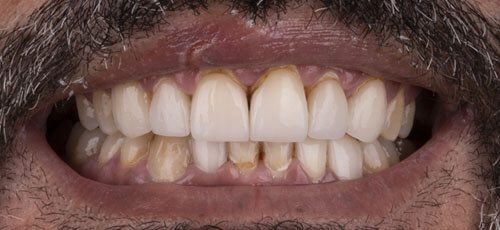Case 27 - Before