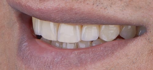 Case 15 - Before