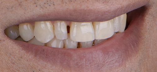 Case 20 - Before