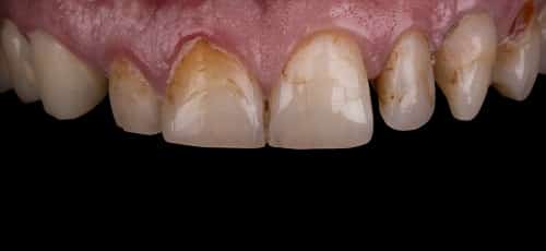 Case 22 - After