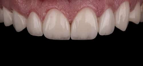 Case 22 - Before