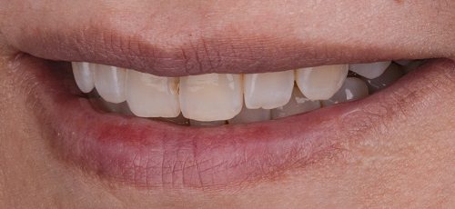 Case 16 - Before