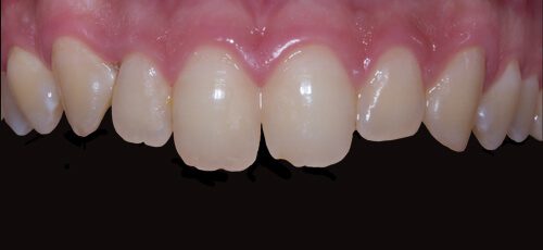 Case 25 - Before