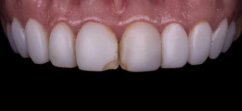 Case 23 - Before