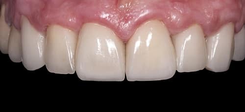 Case 24 - After
