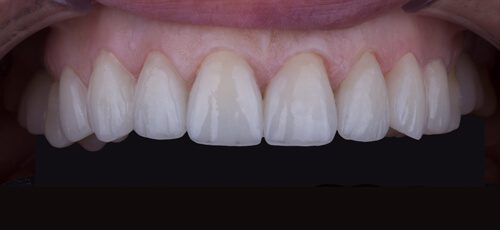 Case 26 - After