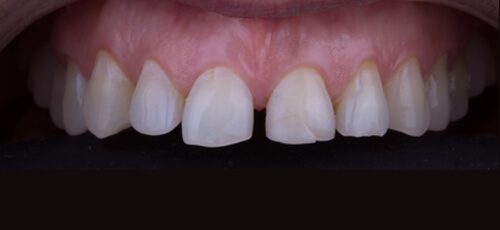 Case 26 - Before