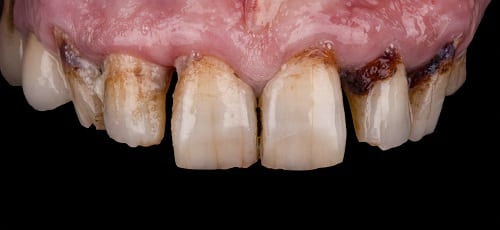 Case 24 - Before