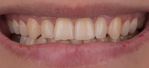 Case 31 - Before