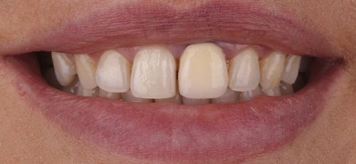Case 37 - Before