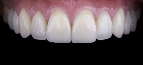 Case 38 - Before
