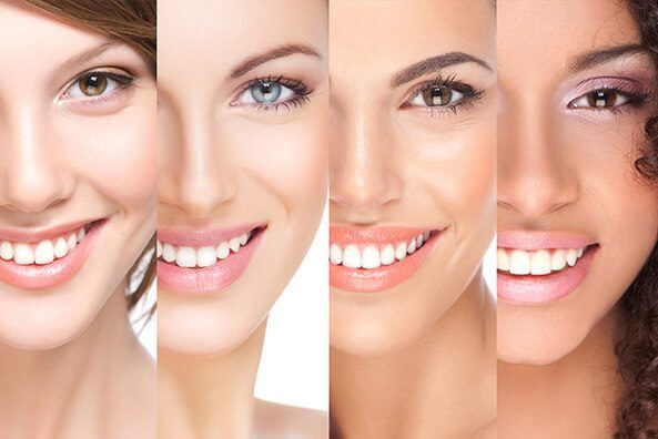 Teeth Straightening