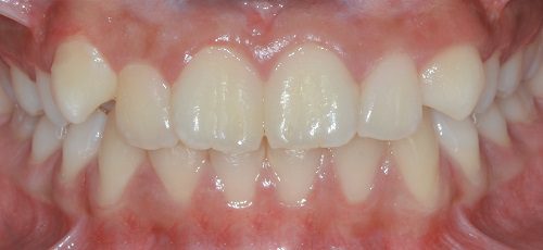 Case 2 - Before