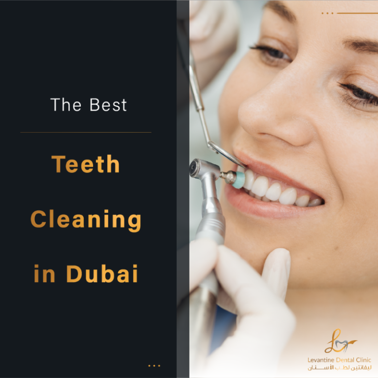 Teeth cleaning