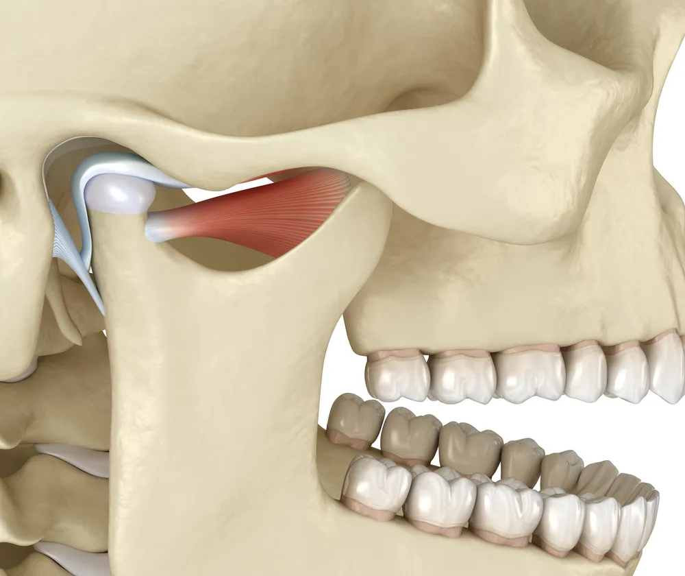 TMJ Disorders