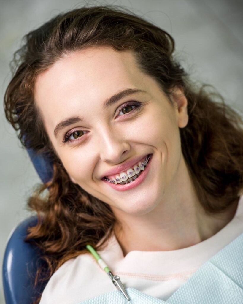 Procedure for getting Dental Braces
