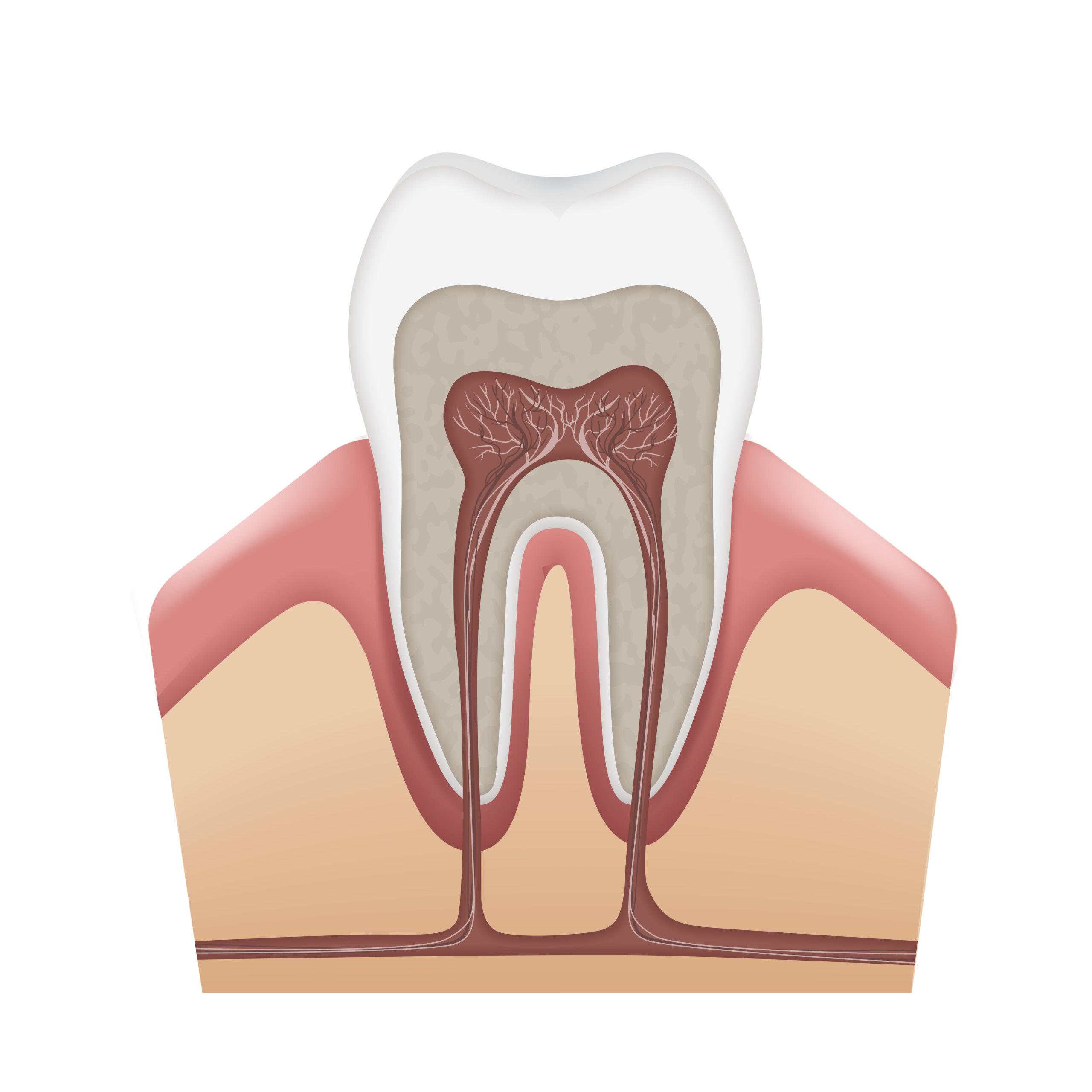Root Canal Treatment in Dubai