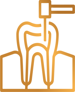 Root Canals