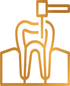 Root Canals