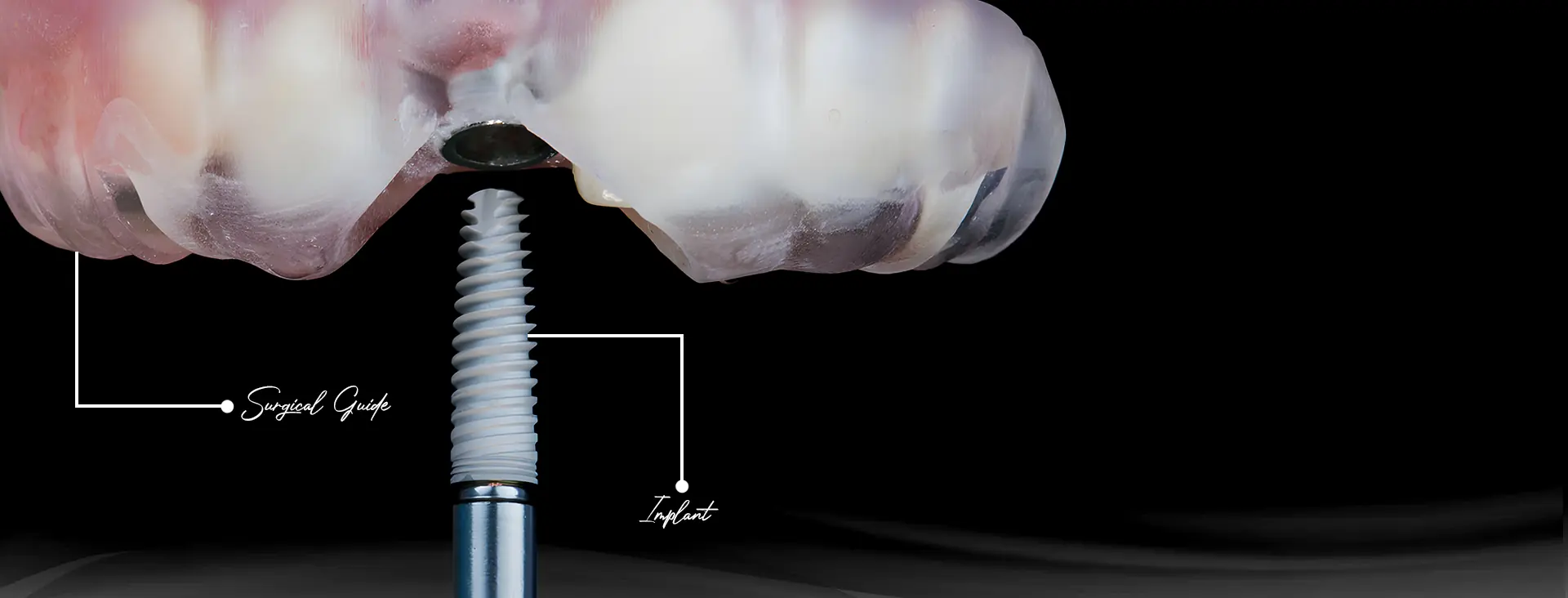 Guided Surgery