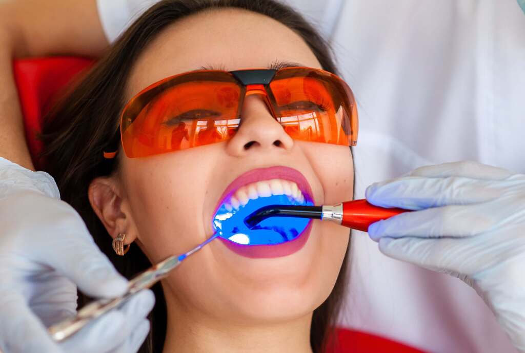 Laser Teeth Whitening Dubai