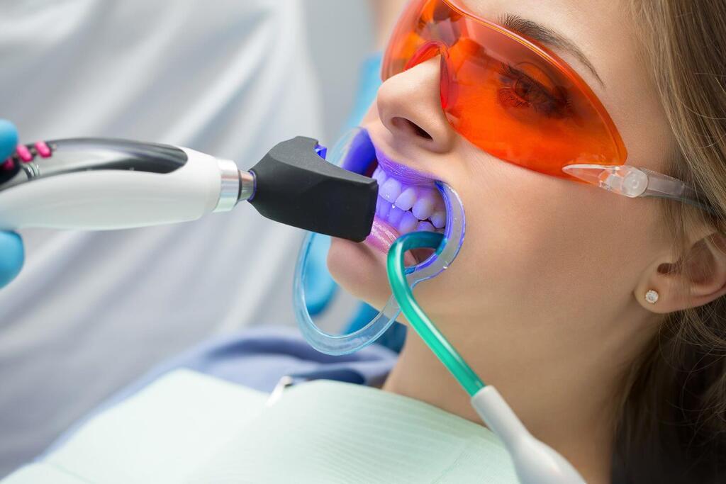 Zoom Teeth Whitening Dubai