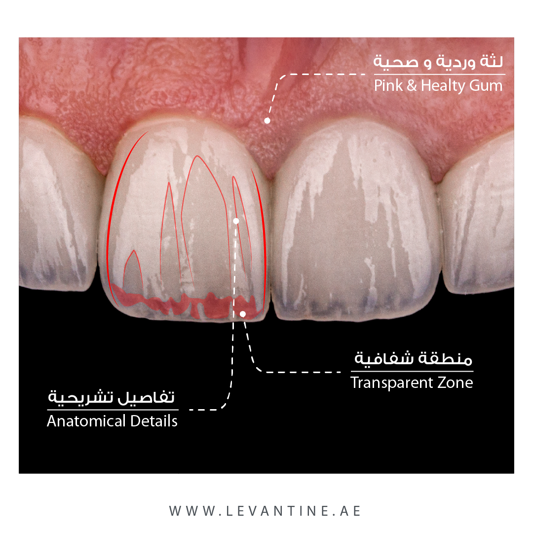 benefits of dental veneers