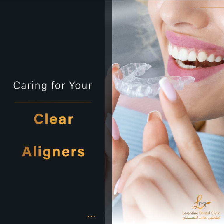 Benefits of Clear Aligners