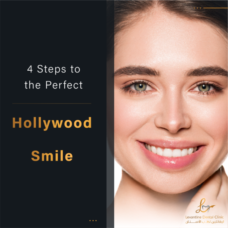 4 Steps To Get Your Hollywood Smile