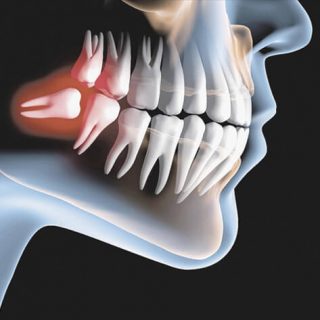Oral & Maxillofacial Surgery Dubai