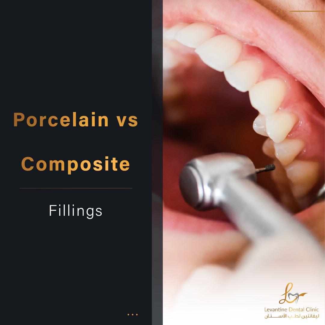 Porcelain Vs Composite Fillings Making The Right Choice For Your Smile