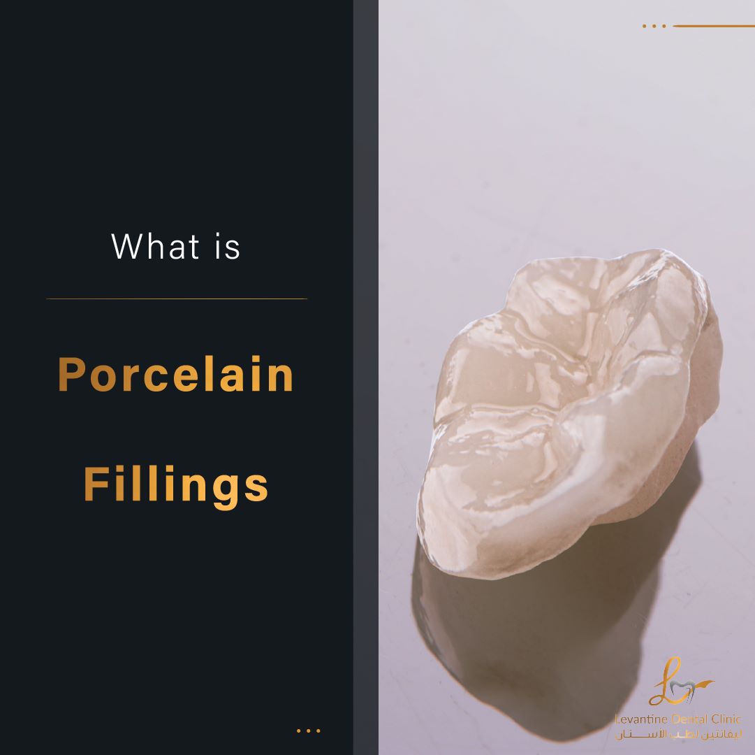 What Is Porcelain Fillings? Every Thing You Need To Know