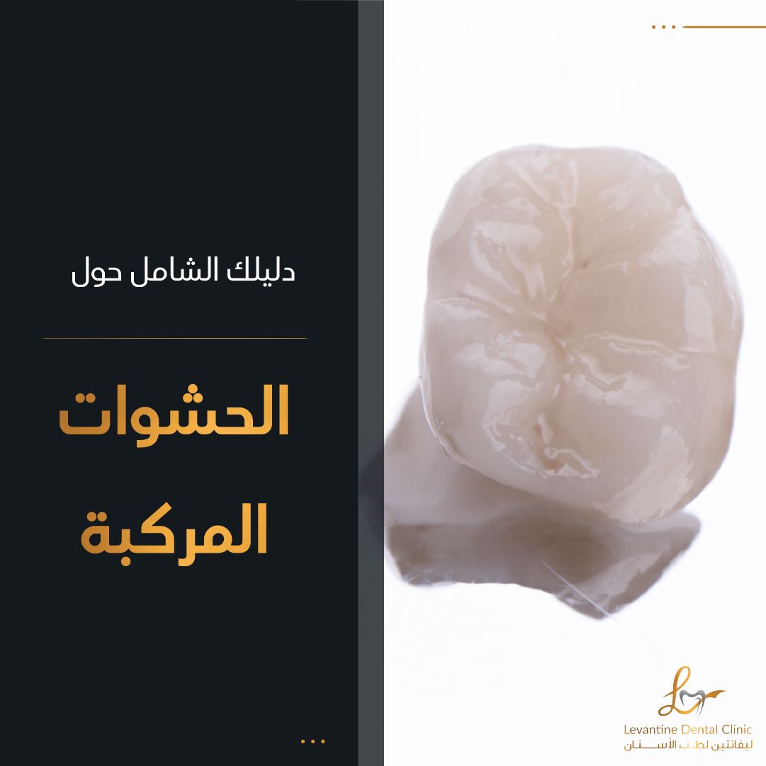 دليلك لحشوات الأسنان المركبة ( الكمبوزيت)
