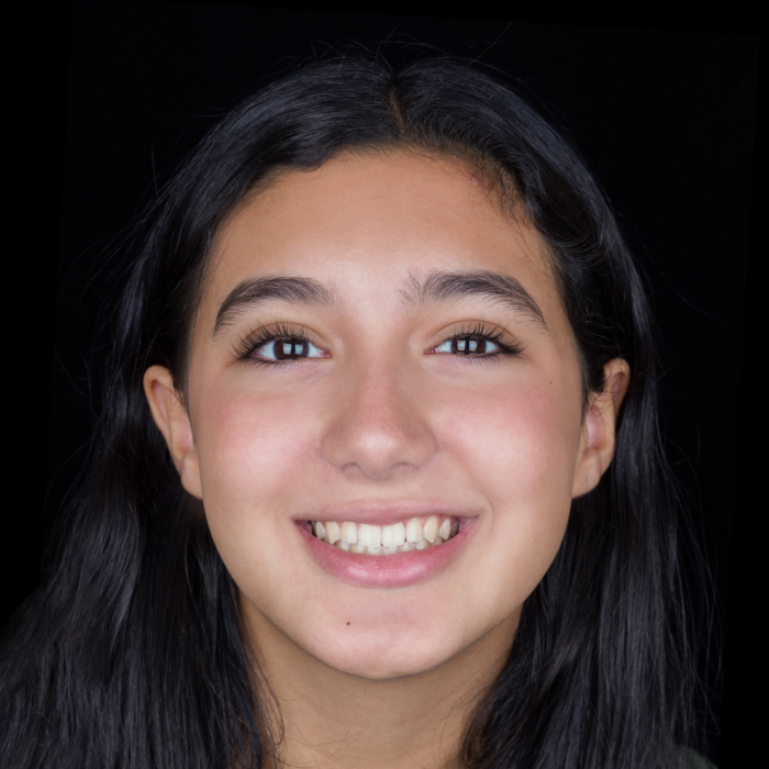 LOGAIN happy patients